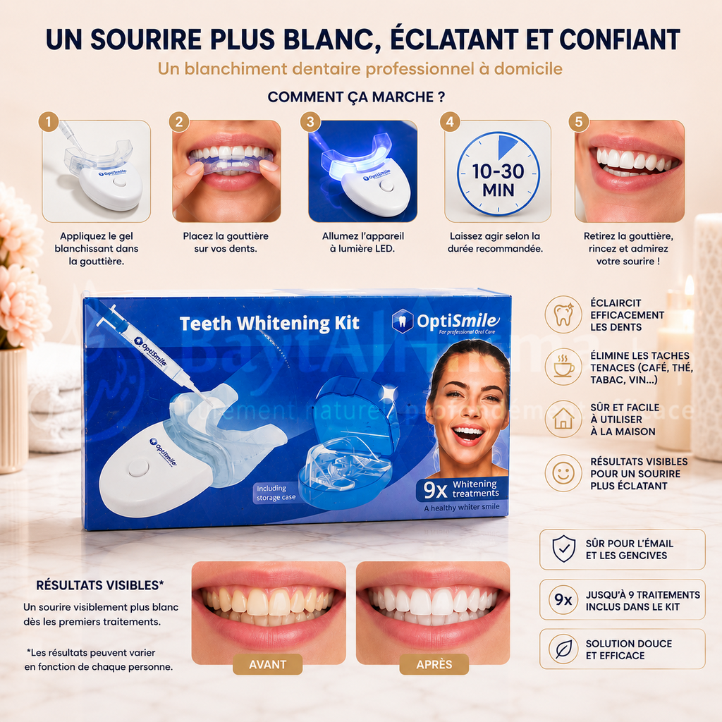 Kit de Blanchiment Dentaire Professionnel OptiSmile - 9 Traitements (Avec Étui de Rangement) - مجموعة تبييض الأسنان الاحترافية أوبتي سمايل (OptiSmile) - تكفي لـ 9 جلسات (مع علبة تخزين)